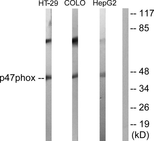 NCF1 / p47phox / p47 phox Antibody - Western blot analysis of lysates from HT-29, COLO205, and HepG2 cells, , using p47 phox Antibody. The lane on the right is blocked with the synthesized peptide.