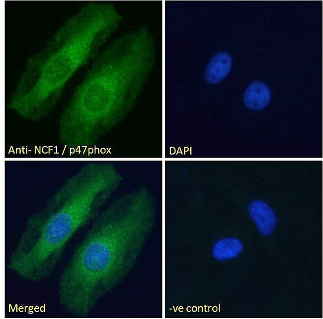 NCF1 / p47phox / p47 phox Antibody - NCF1 / p47phox Antibody Immunofluorescence analysis of paraformaldehyde fixed HeLa cells, permeabilized with 0.15% Triton. Primary incubation 1hr (10ug/ml) followed by Alexa Fluor 488 secondary antibody (2ug/ml), showing cytoplasmic staining. The nuclear stain is DAPI (blue). Negative control: Unimmunized goat IgG (10ug/ml) followed by Alexa Fluor 488 secondary antibody (2ug/ml).