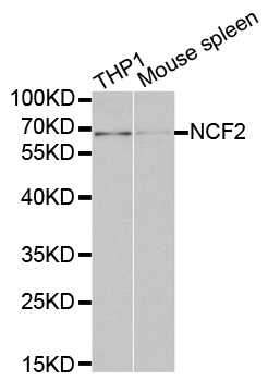 NCF2 / NOXA2 / p67phox Antibody - Western blot analysis of extracts of various cell lines, using NCF2 antibody at 1:1000 dilution. The secondary antibody used was an HRP Goat Anti-Rabbit IgG (H+L) at 1:10000 dilution. Lysates were loaded 25ug per lane and 3% nonfat dry milk in TBST was used for blocking.