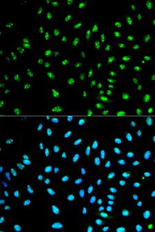 NCF2 / NOXA2 / p67phox Antibody - Immunofluorescence analysis of HeLa cells using NCF2 antibody. Blue: DAPI for nuclear staining.
