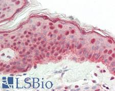 NCOA2 / TIF2 Antibody - Human Skin: Formalin-Fixed, Paraffin-Embedded (FFPE)