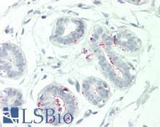NCR3LG1 / B7H6 Antibody - Human Breast: Formalin-Fixed, Paraffin-Embedded (FFPE)