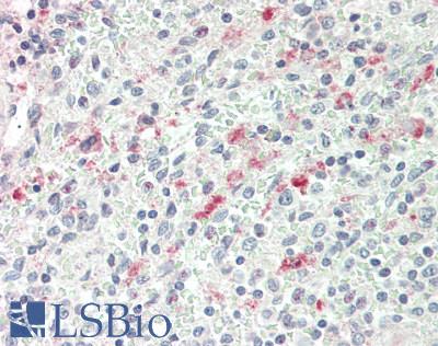 NCR3LG1 / B7H6 Antibody - Human Spleen: Formalin-Fixed, Paraffin-Embedded (FFPE)