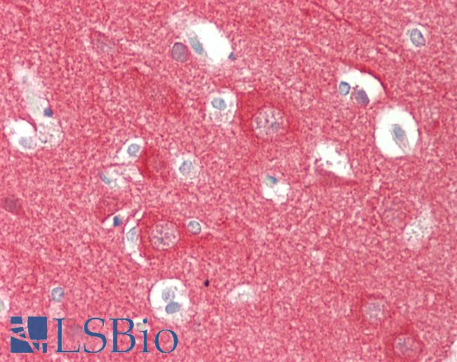 NCS1 / Neuronal Calcium Sensor Antibody - Anti-NCS1 / NCS-1 antibody IHC staining of human brain, cortex. Immunohistochemistry of formalin-fixed, paraffin-embedded tissue after heat-induced antigen retrieval. Antibody concentration 5 ug/ml.