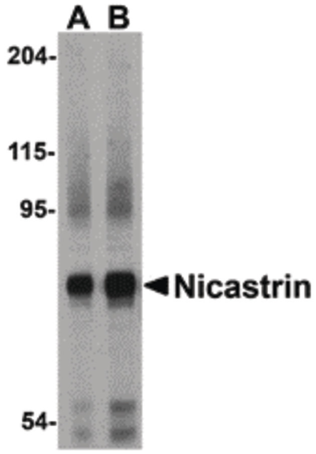 NCSTN / Nicastrin Antibody - Western blot of Nicastrin in human brain tissue lysate with Nicastrin antibody at (A) 0.5 and (B) 1ug/ml.