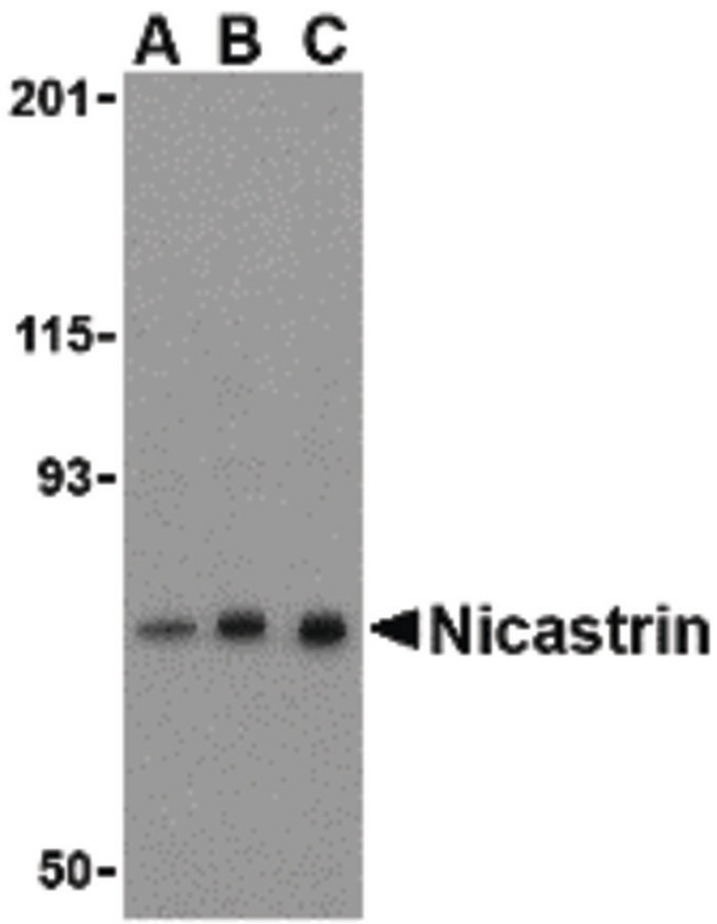 NCSTN / Nicastrin Antibody - Western blot of Nicastrin in mouse brain tissue lysate with Nicastrin antibody at (A) 0.5, (B) 1, and (C) 2 ug/ml.