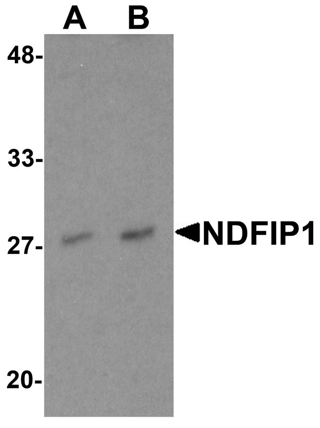 NDFIP1 / N4WBP5 Antibody - Western blot analysis of NDFIP1 in PC-3 cell lysate with NDFIP1 antibody at (A) 0.5 and (B) 1 ug/ml.