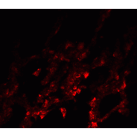 NDFIP1 / N4WBP5 Antibody - Immunofluorescence of NDFIP1 in human lung tissue with NDFIP1 antibody at 20 µg/ml.