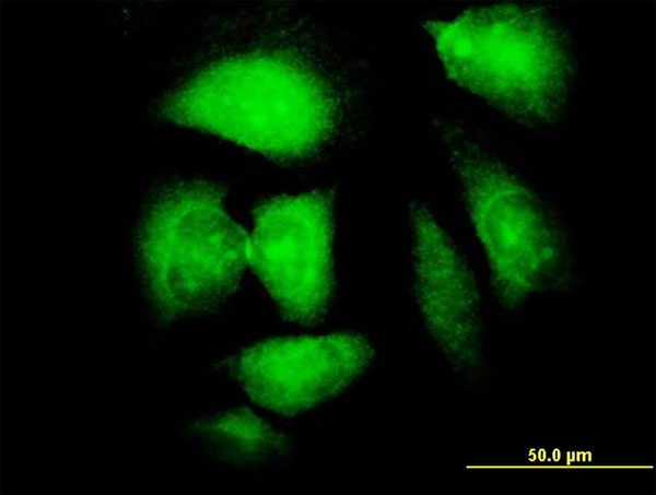NDN / Necdin Antibody - Immunofluorescence of monoclonal antibody to NDN on HeLa cell. [antibody concentration 10 ug/ml]