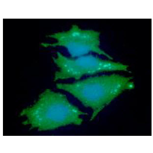 NDRG1 Antibody - ICC/IF analysis of NDRG1 in HeLa cells line, stained with DAPI (Blue) for nucleus staining and monoclonal anti-human NDRG1 antibody (1:100) with goat anti-mouse IgG-Alexa fluor 488 conjugate (Green).
