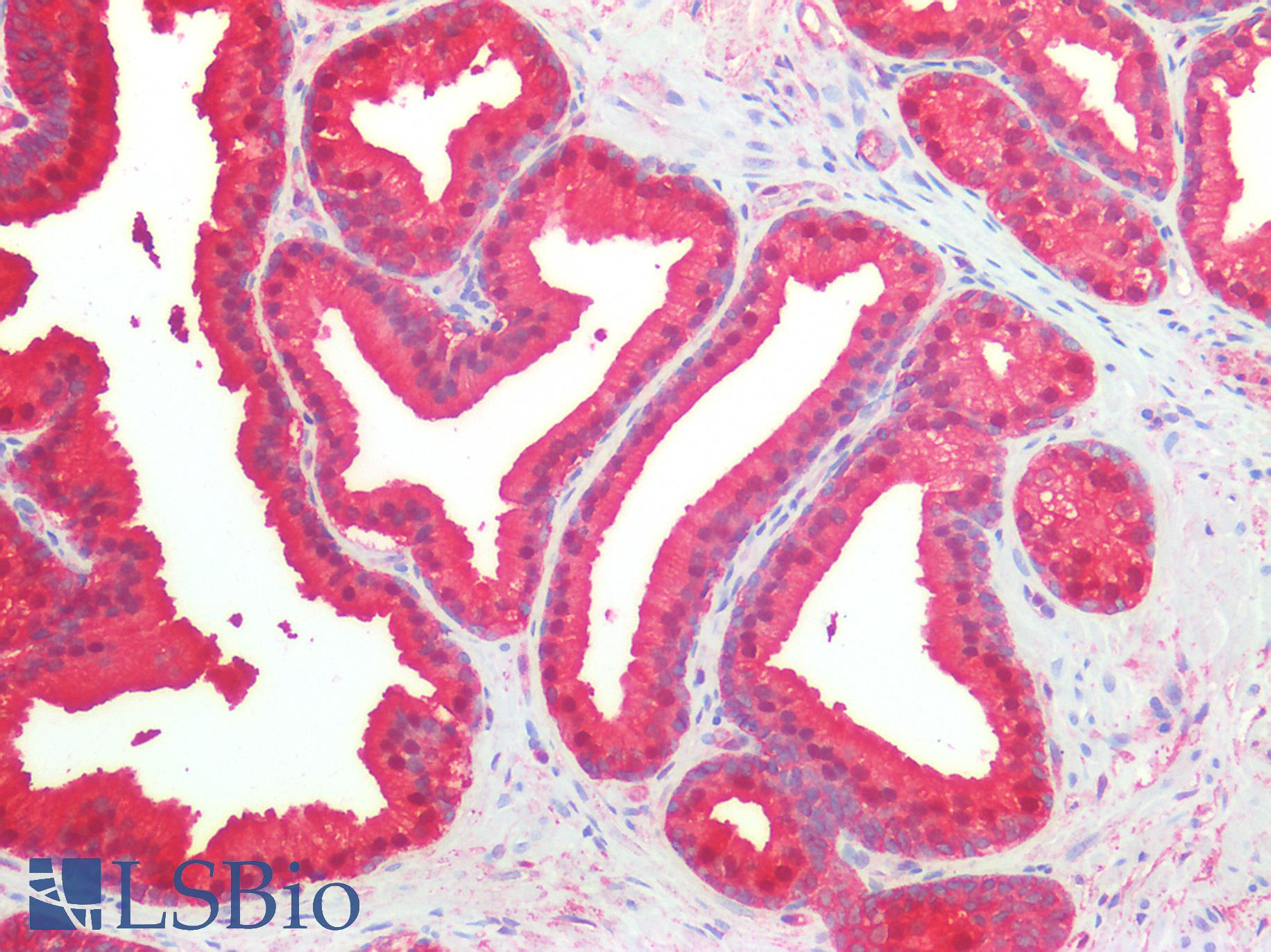 NDRG1 Antibody - Human Prostate: Formalin-Fixed, Paraffin-Embedded (FFPE)