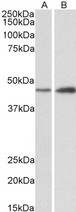 NDRG2 Antibody - Goat Anti-NDRG2 Antibody (0.3µg/ml) staining of Mouse (A) and Rat (B) Brain lysates (35µg protein in RIPA buffer). Detected by chemiluminescencence.