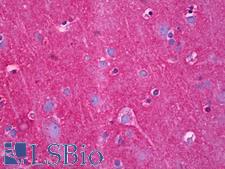 NDRG4 Antibody - Anti-NDRG4 antibody IHC of human brain, cortex neuropil. Immunohistochemistry of formalin-fixed, paraffin-embedded tissue after heat-induced antigen retrieval. Antibody dilution 1:100.