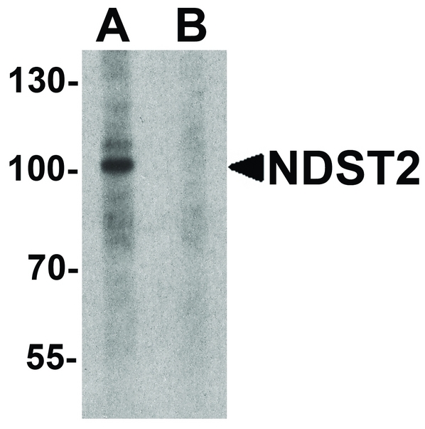 NDST2 Antibody - Western blot analysis of NDST2 in A-20 cell lysate with NDST2 antibody at 1 ug/ml in (A) the absence and (B) the presence of blocking peptide.