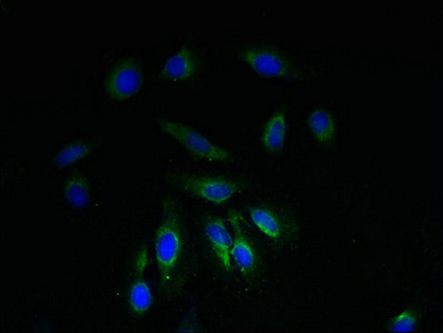 NDUFA1 Antibody - Immunofluorescent analysis of Hela cells using NDUFA1 Antibody at dilution of 1:100 and Alexa Fluor 488-congugated AffiniPure Goat Anti-Rabbit IgG(H+L)