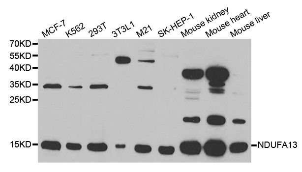 NDUFA13 / GRIM19 Antibody - Western blot analysis of extracts of various cell lines, using NDUFA13 antibody.
