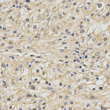 NDUFA13 / GRIM19 Antibody - Immunohistochemistry of paraffin-embedded human kidney using NDUFA13 antibody at dilution of 1:200 (x400 lens)