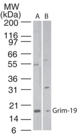 NDUFA13 / GRIM19 Antibody - Western blot of GRIM-19 in A) human heart and B) HeLa cell lysate using antibody at 1:500. Goat anti-rabbit Ig HRP secondary antibody and ECL substrate solution were used for detection.