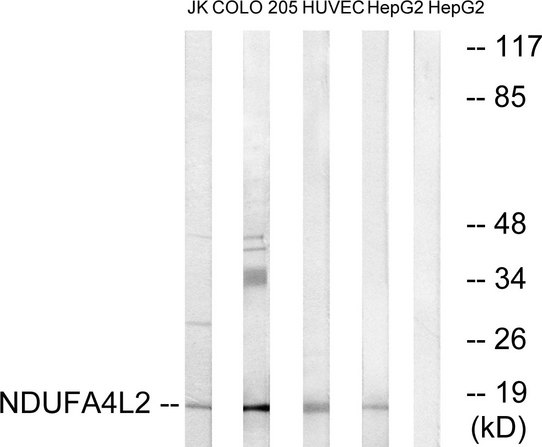 NDUFA4L2 Antibody - Western blot analysis of lysates from HepG2, HUVEC, COLO, and Jurkat cells, using NDUFA4L2 Antibody. The lane on the right is blocked with the synthesized peptide.