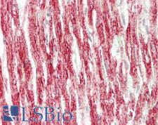 NDUFA7 Antibody - Human Heart: Formalin-Fixed, Paraffin-Embedded (FFPE)
