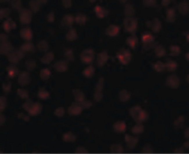 NDUFAF2 / NDUFA12L Antibody - Immunofluorescence of Mimitin in Raji cells with Mimitin antibody at 20 ug/ml.