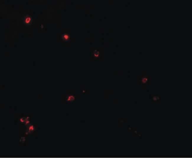 NDUFB9 Antibody - Immunofluorescence of LYRM3 in rat liver tissue with LYRM3 antibody at 20 ug/ml.
