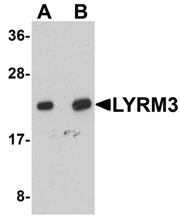 NDUFB9 Antibody - Western blot analysis of LYRM3 in human liver tissue lysate with LYRM3 antibody at (A) 1 and (B) 2 ug/ml.