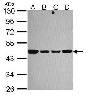 NDUFS2 Antibody - Sample (30 ug of whole cell lysate). A:293T, B: A431 , C: JurKat, D: Raji. 10% SDS PAGE. NDUFS2 antibody diluted at 1:1000.