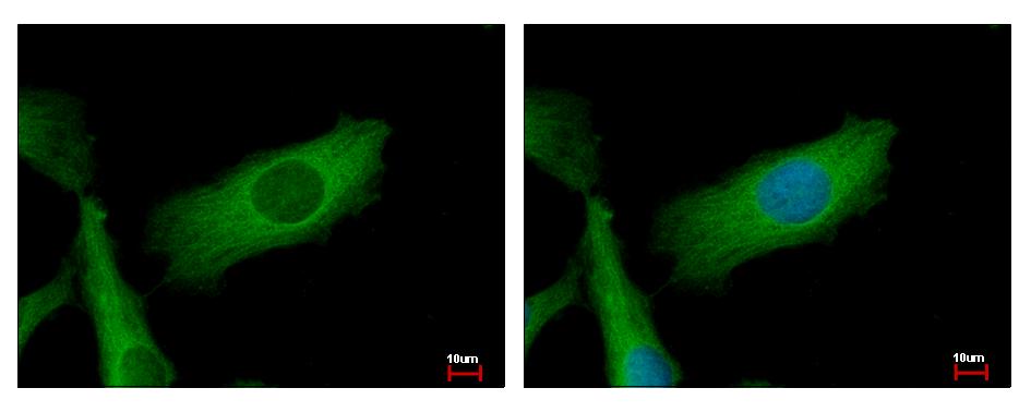 NDUFS2 Antibody - NDUFS2 antibody detects NDUFS2 protein at mitochondria by immunofluorescent analysis. HeLa cells were fixed in 2% paraformaldehyde/culture medium at 37 for 30 min. NDUFS2 protein stained by NDUFS2 antibody diluted at 1:500. 