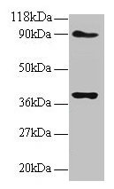 NDUFS5 Antibody - Western blot All lanes: NADH dehydrogenase [ubiquinone] iron-sulfur protein 5 antibody at 2µg/ml Lane 1: EC109 whole cell lysate Lane 2: 293T whole cell lysate Secondary Goat polyclonal to rabbit IgG at 1/15000 dilution Predicted band size: 11.7 kDa Observed band size: 40 kDa
