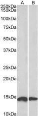 NDUFS6 Antibody - Goat Anti-NDUFS6 Antibody (0.1µg/ml) staining of Mouse (A) and Rat (B) Heart lysates (35µg protein in RIPA buffer). Detected by chemiluminescencence.