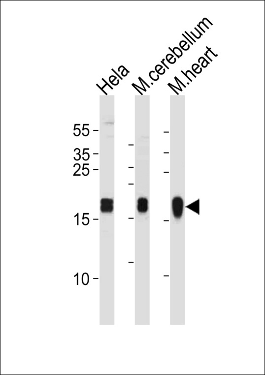 NDUFS7 Antibody - NDUFS7 Antibody western blot of HeLa cell line and mouse cerebellum,heart tissue lysates (35 ug/lane). The NDUFS7 antibody detected the NDUFS7 protein (arrow).