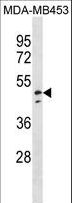 NDUFV1 Antibody - NDUFV1 Antibody western blot of MDA-MB453 cell line lysates (35 ug/lane). The NDUFV1 antibody detected the NDUFV1 protein (arrow).