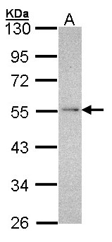 NDUFV1 Antibody - Sample (30 ug of whole cell lysate). A: Hep G2 . 10% SDS PAGE. NDUFV1 antibody diluted at 1:1000.