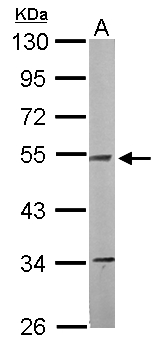 NDUFV1 Antibody - Sample (50 ug of whole cell lysate). A: Mouse brain. 10% SDS PAGE. NDUFV1 antibody diluted at 1:1000.