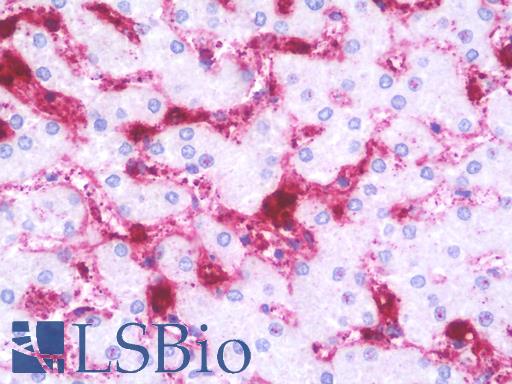 NDUFV2 Antibody - Anti-NDUFV2 antibody IHC staining of human liver. Immunohistochemistry of formalin-fixed, paraffin-embedded tissue after heat-induced antigen retrieval. Antibody dilution 1:100.