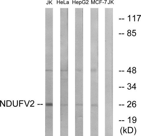 NDUFV2 Antibody - Western blot analysis of lysates from Jurkat, HeLa, HepG2, and MCF-7 cells, using NDUFV2 Antibody. The lane on the right is blocked with the synthesized peptide.