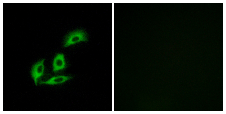NECAB3 Antibody - Immunofluorescence analysis of A549 cells, using NECAB3 Antibody. The picture on the right is blocked with the synthesized peptide.