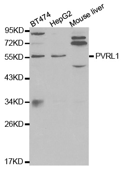 Nectin-1 / PVRL1 Antibody - Western blot analysis of extracts of various cell lines, using PVRL1 antibody.