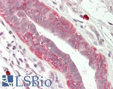 Nectin-1 / PVRL1 Antibody - Human Breast: Formalin-Fixed, Paraffin-Embedded (FFPE)