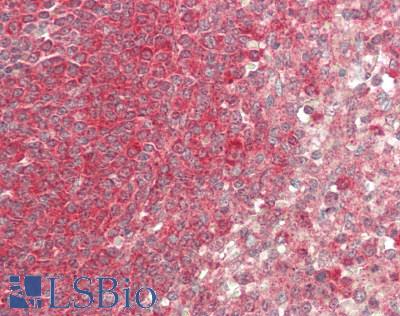 NEDD4 Antibody - Human Spleen: Formalin-Fixed, Paraffin-Embedded (FFPE)