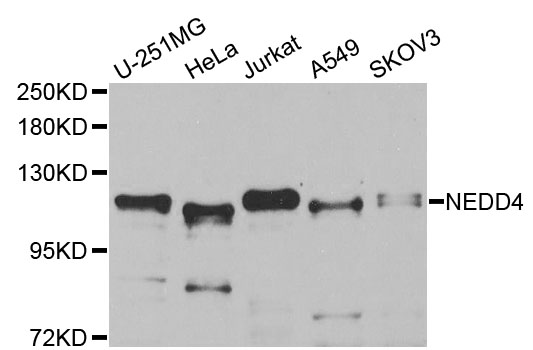 NEDD4 Antibody - Western blot analysis of extracts of various cell lines, using NEDD4 antibody at 1:1000 dilution. The secondary antibody used was an HRP Goat Anti-Rabbit IgG (H+L) at 1:10000 dilution. Lysates were loaded 25ug per lane and 3% nonfat dry milk in TBST was used for blocking. An ECL Kit was used for detection and the exposure time was 30s.