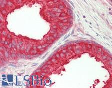 NEDD4L / NEDD4-2 Antibody - Human Prostate: Formalin-Fixed, Paraffin-Embedded (FFPE)