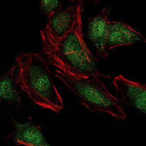 NEDD8 Antibody - Immunofluorescence of HeLa cells using NEDD8 mouse monoclonal antibody (green). Red: Actin filaments have been labeled with Alexa Fluor-555 phalloidin.
