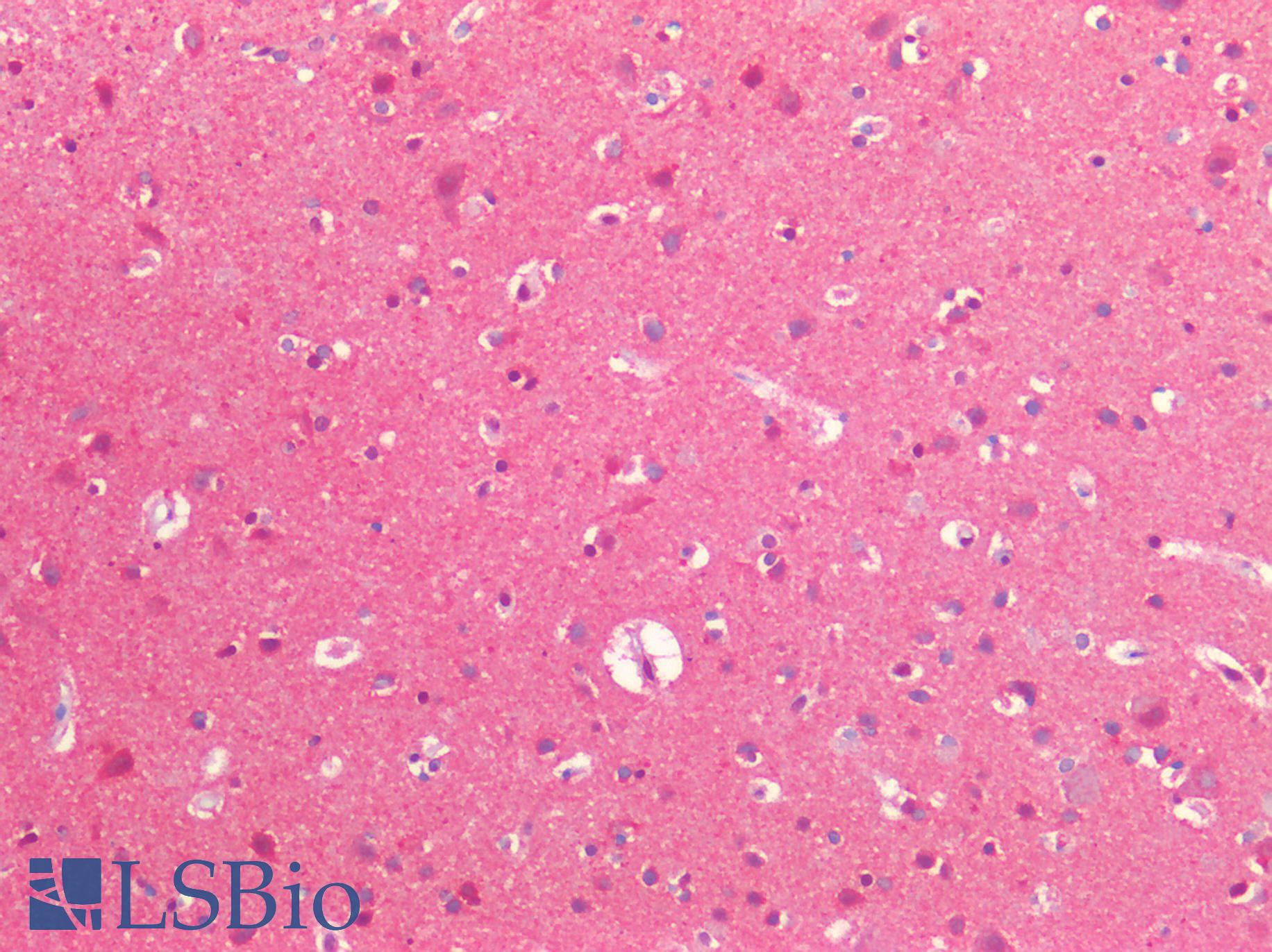 NEDD8 Antibody - Human Brain, Cortex: Formalin-Fixed, Paraffin-Embedded (FFPE)