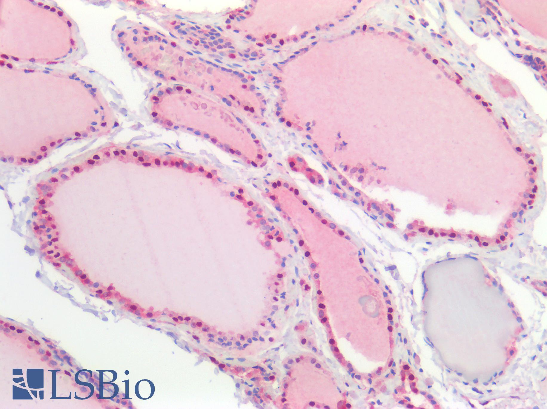 NEDD8 Antibody - Human Thyroid: Formalin-Fixed, Paraffin-Embedded (FFPE)
