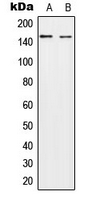 NEDL2 / HECW2 Antibody - Western blot analysis of HECW2 expression in A549 (A); NIH3T3 (B) whole cell lysates.