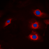 NEDL2 / HECW2 Antibody - Immunofluorescent analysis of HECW2 staining in A549 cells. Formalin-fixed cells were permeabilized with 0.1% Triton X-100 in TBS for 5-10 minutes and blocked with 3% BSA-PBS for 30 minutes at room temperature. Cells were probed with the primary antibody in 3% BSA-PBS and incubated overnight at 4 C in a humidified chamber. Cells were washed with PBST and incubated with a DyLight 594-conjugated secondary antibody (red) in PBS at room temperature in the dark. DAPI was used to stain the cell nuclei (blue).