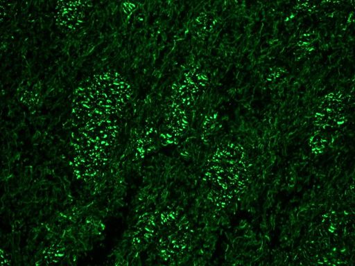NEFH / NF-H Antibody - Immunofluorescence staining of rat brain with NEFH / NF-H (clone RNF404)