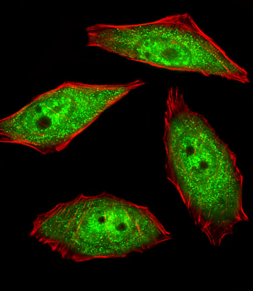 NEK2 Antibody - Fluorescent image of U251 cells stained with hNEK2-C410. Antibody was diluted at 1:25 dilution. An Alexa Fluor 488-conjugated goat anti-rabbit lgG at 1:400 dilution was used as the secondary antibody (green). Cytoplasmic actin was counterstained with Alexa Fluor 555 conjugated with Phalloidin (red).
